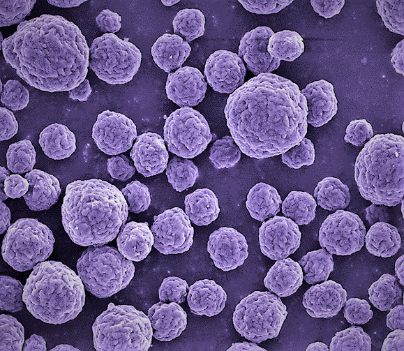 False colour image of cellulose microbeads.